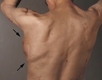мышцы спины- Упражнения для укрепления мышц спины